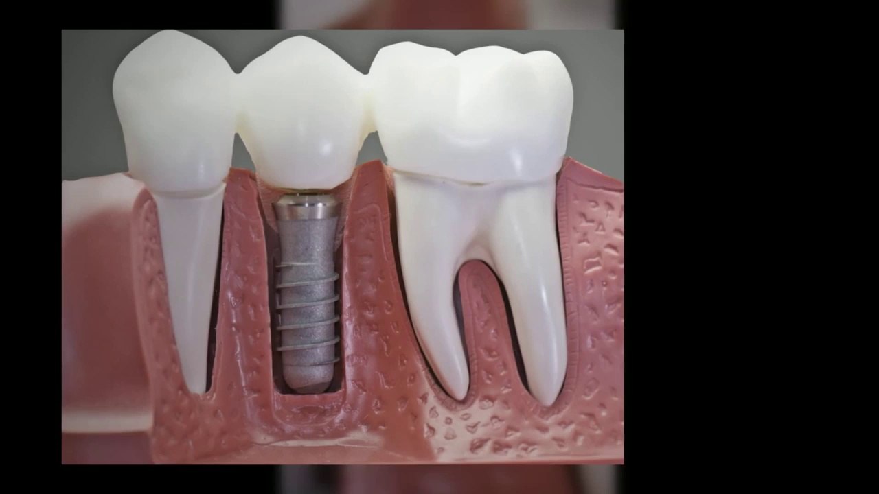 Dentist Frisco TX | Call 972-335-7666