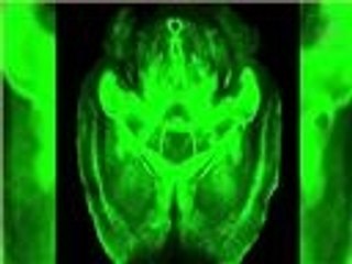 تقنية علمية تجعل الأنسجة الحية شفافة