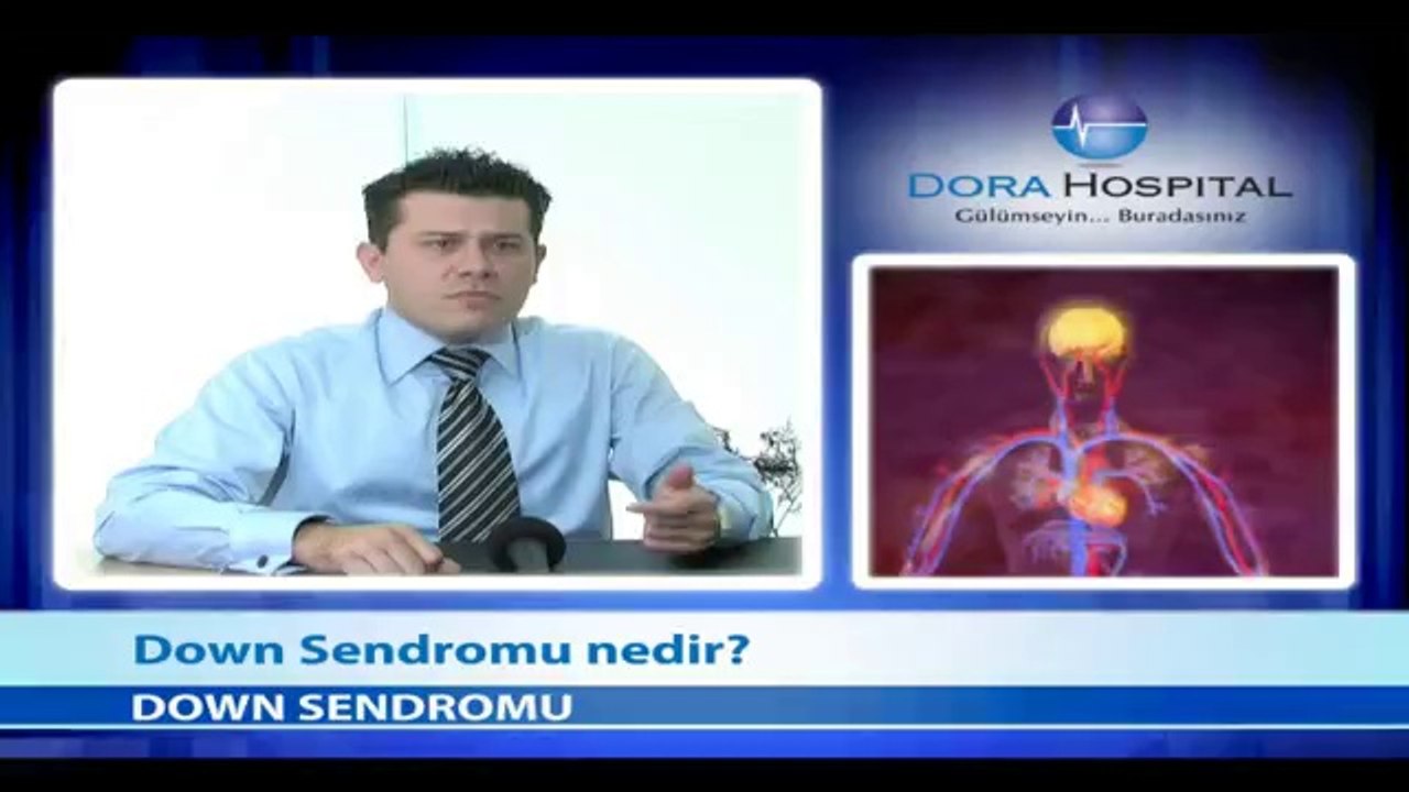 Down Sendromu Nedir? - Fragman