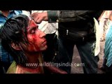 Devotee receives first-aid after self-flagellation during Muharram