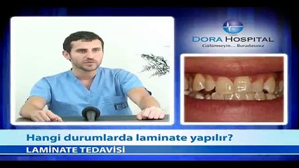 Hangi Durumlarda Laminate Yapılır? - Fragman
