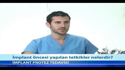 İmplant Öncesi Yapılan Tetkikler Nelerdir? - Fragman