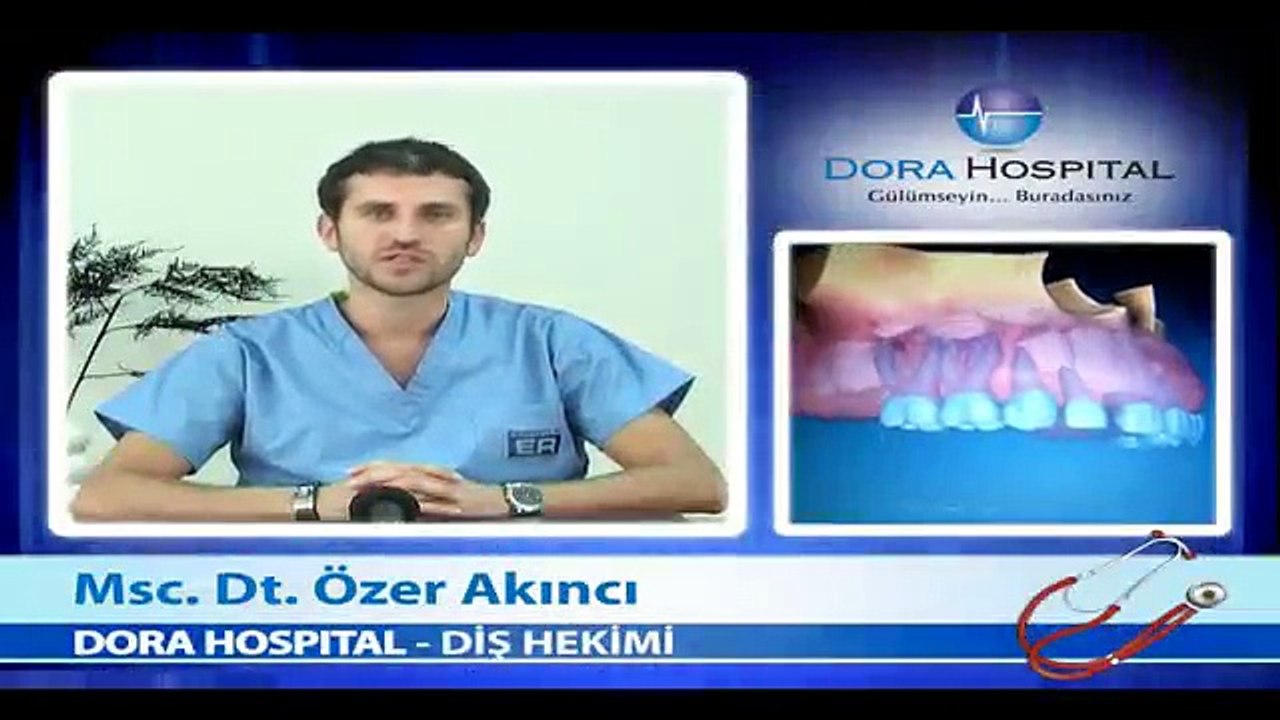 Ortodontik Problemlerin Sebepleri Nelerdir? - Fragman