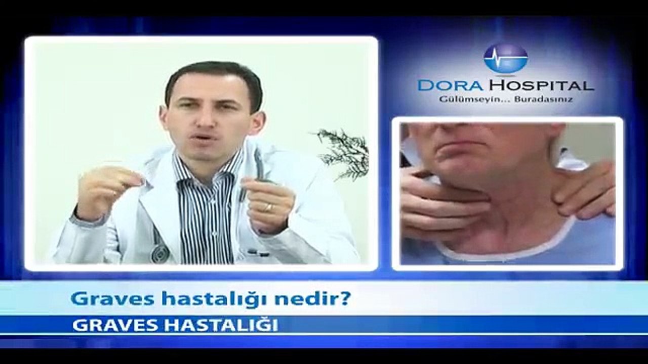 Graves Hastalığı Nedir? - Fragman