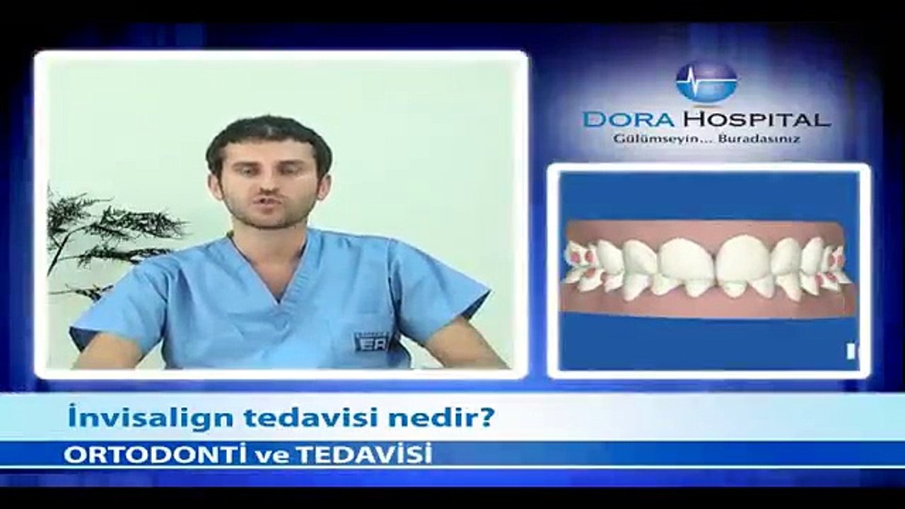 İnvisalign Tedavisi Nedir? - Fragman