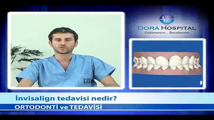 İnvisalign Tedavisi Nedir? - Fragman