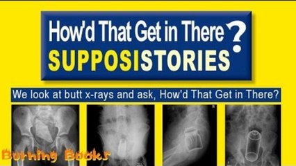 We Play SupposiStories and ask “How did that get in there?”