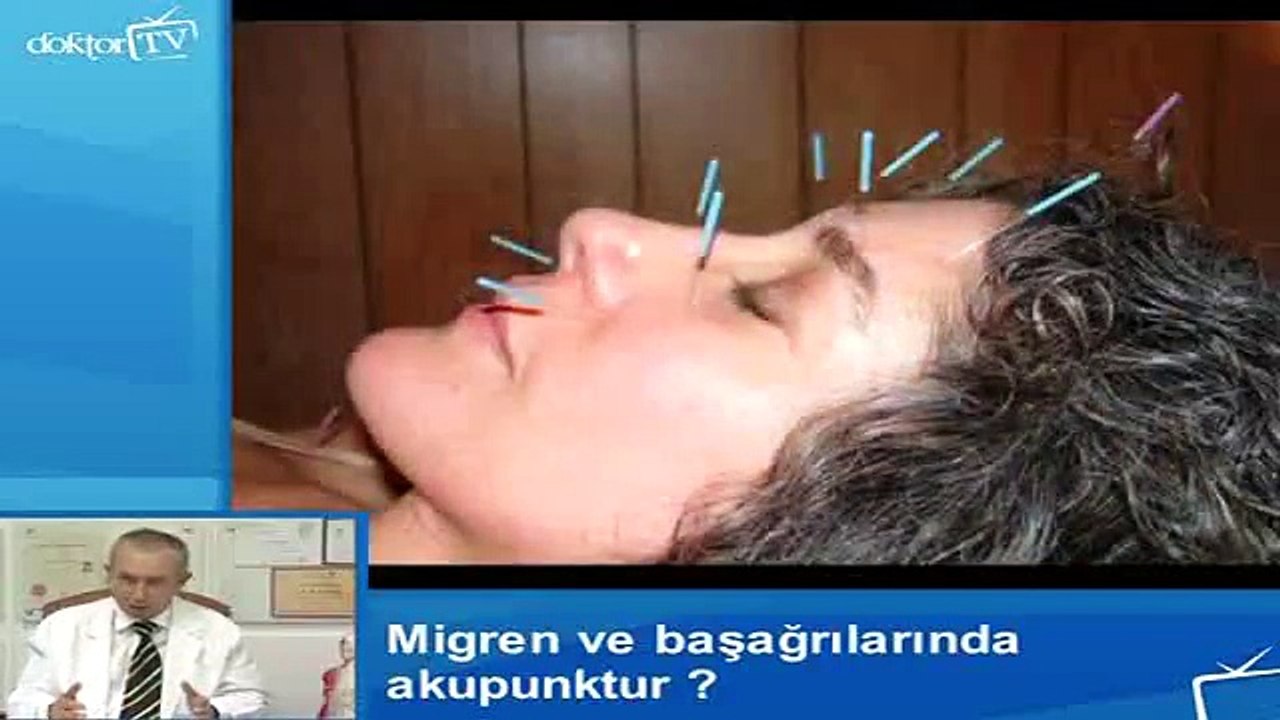 Migren ve Başağrılarında Akupunktur Uygulamaları Nasıl Yapılır? - Fragman