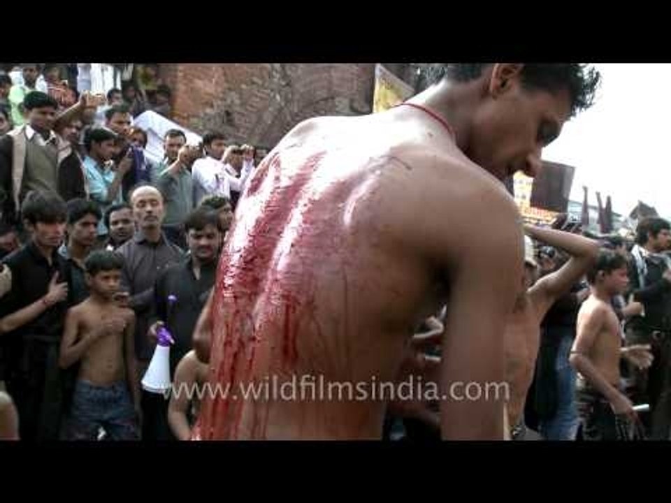 Bruises from self whipping with sharp blades, on Muharram