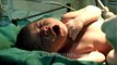 Caesarean section: a new baby is born!