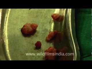 Freshly extracted cysts from the cancer infected breast!