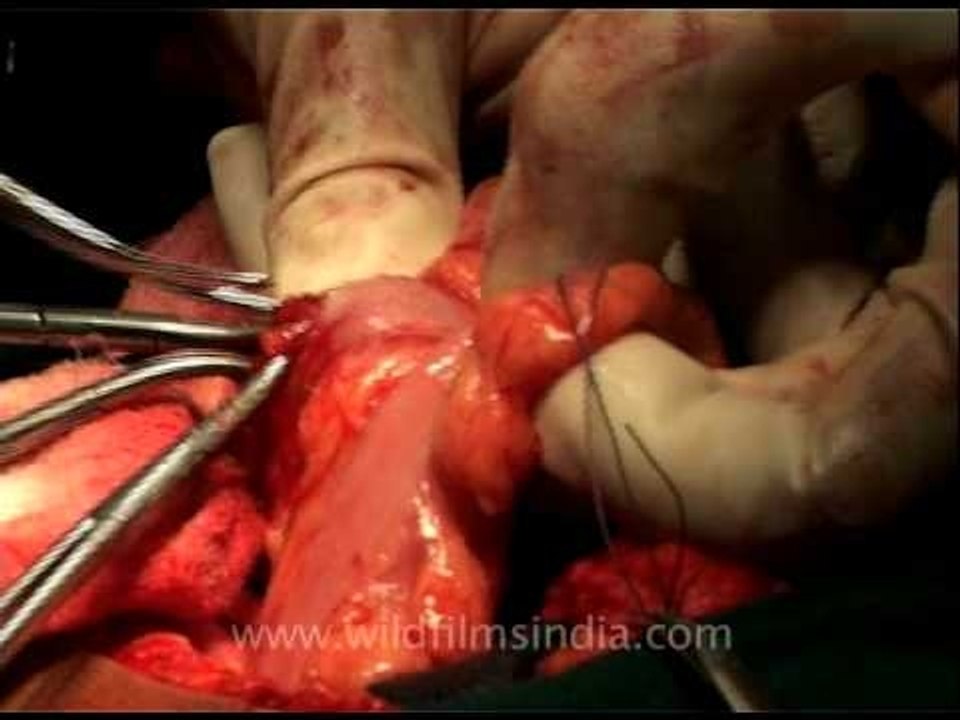 Surgeons at work !