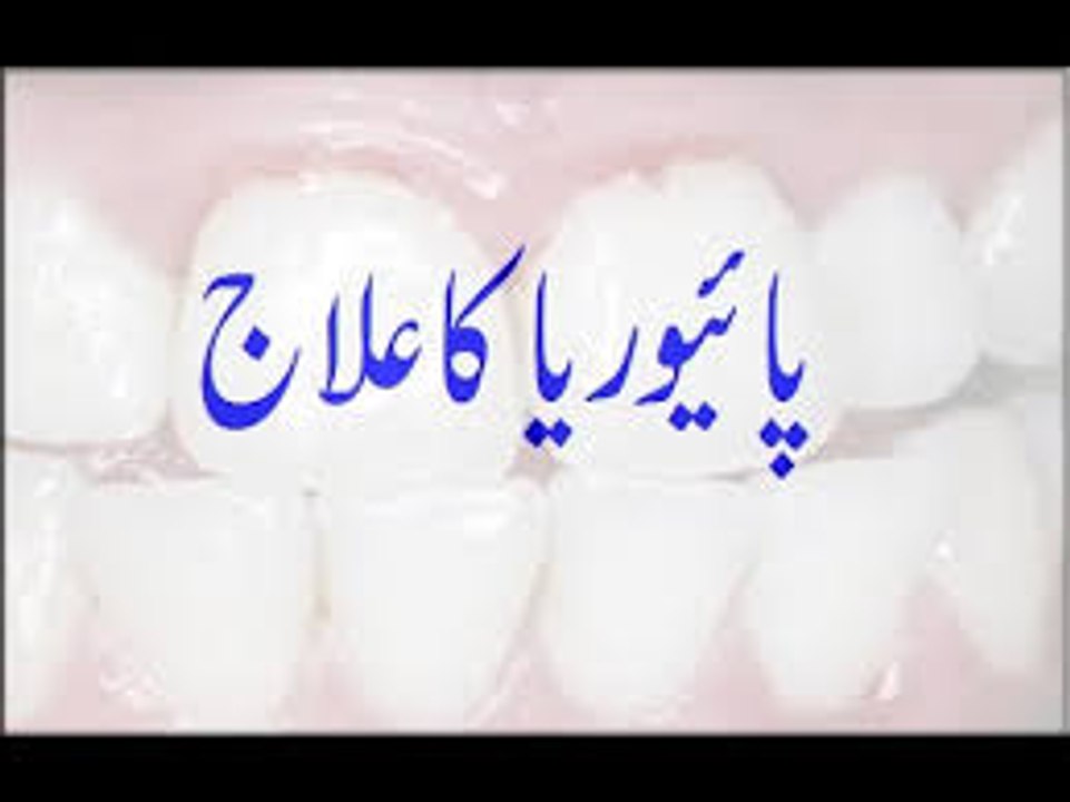 Phyorrhea Ka Ilaj
