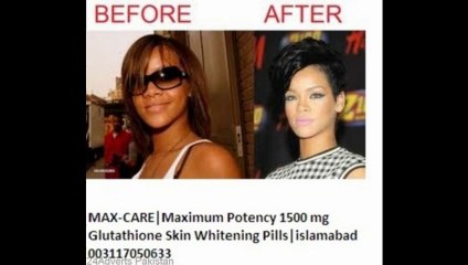 Glutathione Fairer Skin Anti-Aging Capsules Made in Uk Real brand in pakistan-03134991116