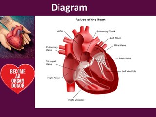 Heart valve surgery in Delhi