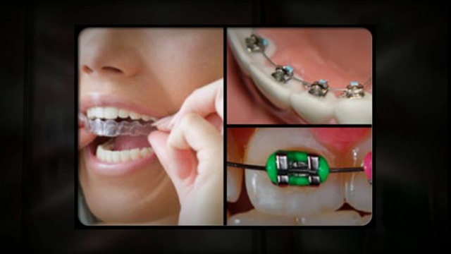 Littleton Orthodontists July2014