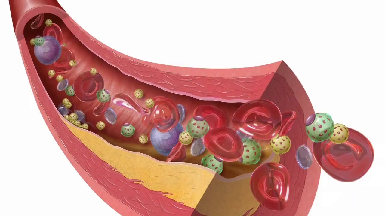 Healthy Heart, Heart Defects, Heart Disease Specialist, Heart Specialist, Heart Valvular Disease