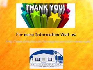 What Are Porcelain Veneers