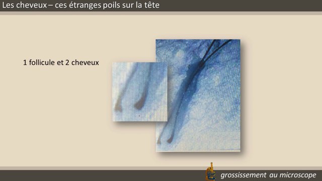 Les cheveux, ces étranges poils sur la tête.