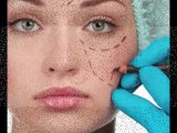 Hair Transplant,Cosmetic Surgery Centre In Vadodara | APEX Plastic & Cosmetic Surgery Center