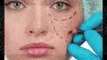 Hair Transplant,Cosmetic Surgery Centre In Vadodara | APEX Plastic & Cosmetic Surgery Center