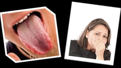 Como quitar el mal aliento rapido !