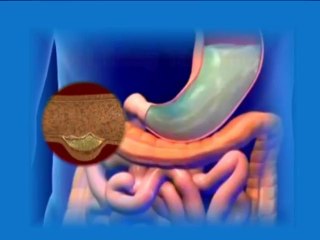 Nhật ký Bệnh nhân Đại Tràng - Bác Phạm Quy