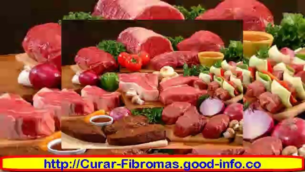 Como Curar Fibromas De Forma Natural, Miomas En El Embarazo, Mioma Gigante, Mioma Cervical