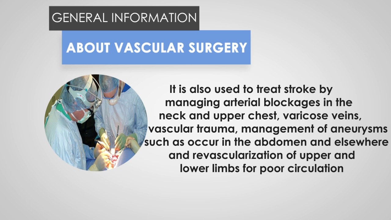 General Information about Vascular Surgery