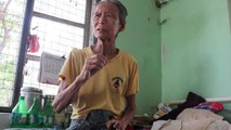 En Birmanie, la lutte contre une maladie oubliée, la lèpre