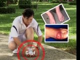Viên Gout Tâm Bình - Nguồn Gốc Thảo Dược - Điều Trị Bệnh Gout