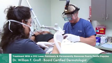 Pearly Penile Papules Treatment