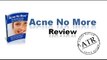 Acne No More Reviews Video Honest Review of No More Acne Or Acne No More ebook