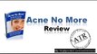 Acne No More Reviews Video Honest Review of No More Acne. DOes it really WORK