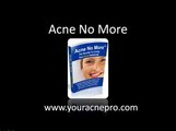 Acne Treatment Program Acne No More Review acne no more book