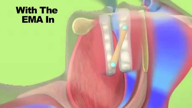 Best Dentist In Woodbury, MN How Does A Dentist Treat Snoring & Sleep Apnea?