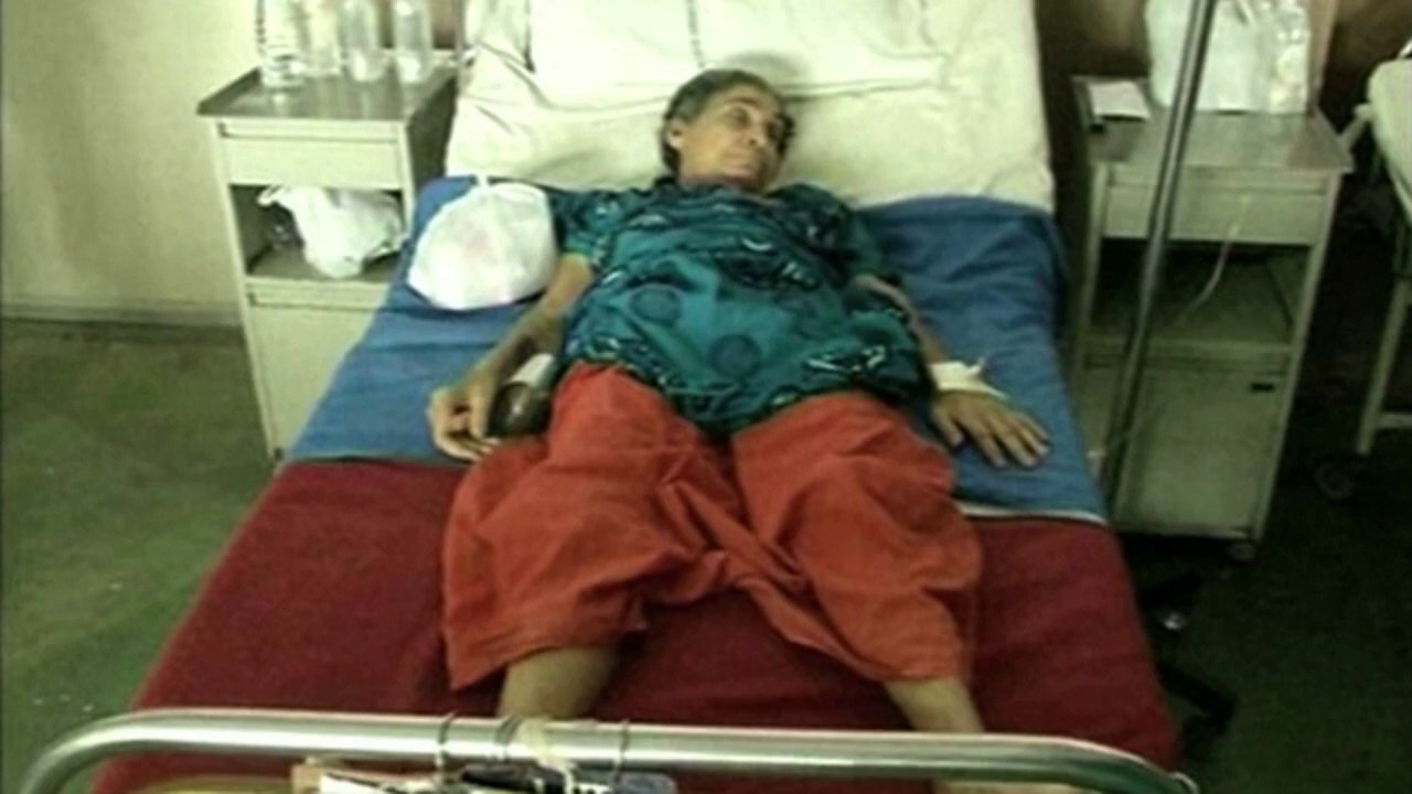 Inde: des médecins retirent un foetus 36 ans après la grossesse