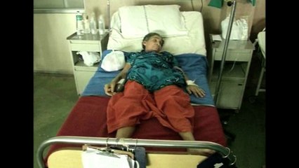 Extirpan feto después de 36 años