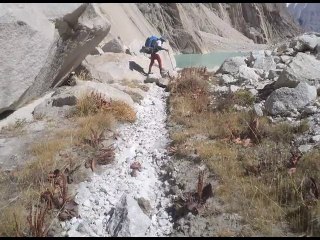 World This Morning- Prosthodontics in Pakistan & Trango Towers Climbers