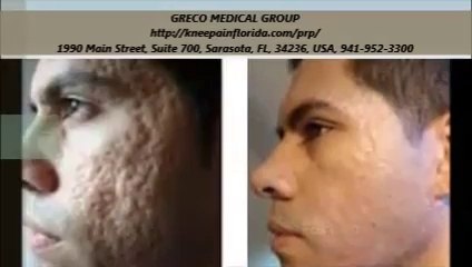 GRECO MEDICAL GROUP : PRP Treatment