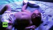 India: Baby born with two faces strives to live