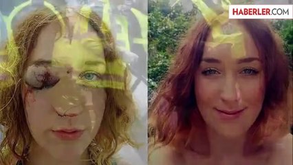 Londra'daki Nothing Hill Karnavalına Gölge Düşüren Dayak Olayı