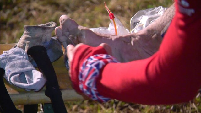 UTMB® 2014 - Hommage aux pieds des coureurs, sacrifiés sur l'autel du Trail