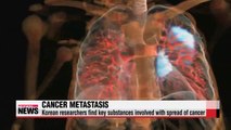 Local researchers find key substances involved in spread of cancer