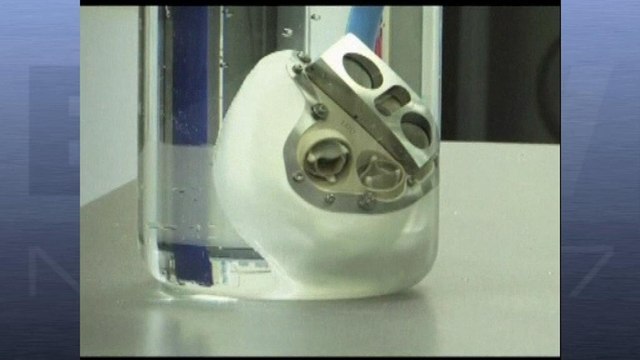 Une seconde greffe de cœur artificiel réalisée à Nantes