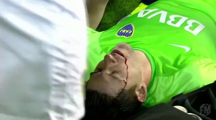 Boca Juniors keeper hit in head by rock missile thrown by crowd