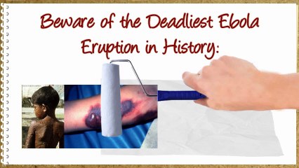 Beware of the Deadliest Ebola Eruption in History
