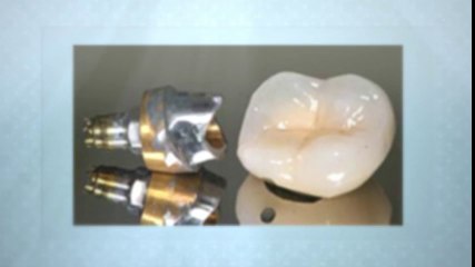 Dental Implants Westminster Aug2014