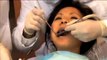 Dental Crowns Laguna Niguel CA,Dental Crowns Laguna Niguel