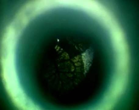 Série de microscopes : le microscope simple